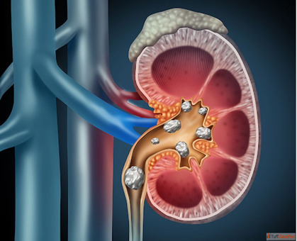 Which Urology Doctor in Dehradun Offers the Best Care