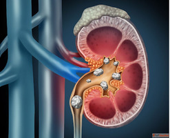 Which Urology Doctor in Dehradun Offers the Best Care