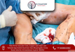 Walk Comfortably Again with Modern Vascular Treatment