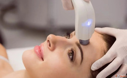 Advanced Q-Switch Technology for Clearer Skin