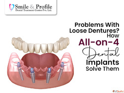 Smile Confidently Again with Long-Lasting Tooth Replacement