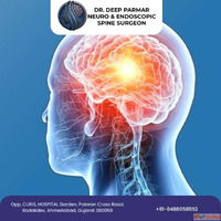 Advanced Brain Hemorrhage Treatment in Ahmedabad by Dr Deep ...