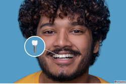 Dental Implants in Indirapuram White Dental Healthcare