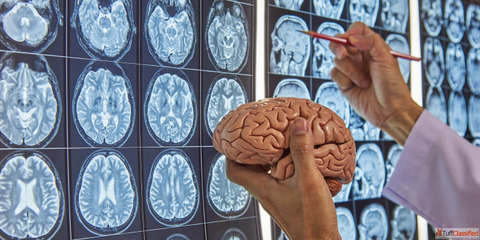 Best Neurosurgeon in Mumbai for Advanced Brain Spine Treatment