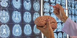 Best Neurosurgeon in Mumbai for Advanced Brain Spine Treatme...