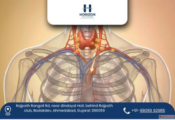 Renowned Thyroid Cancer Surgeon in Ahmedabad