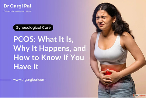 Healthy Lifestyle Support for Women with PCOS