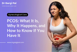 Healthy Lifestyle Support for Women with PCOS