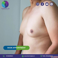 Gynecomastia Correction in Ahmedabad at Kosmo Plus Hospital