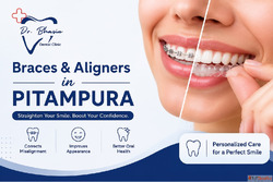 Braces Treatment in Pitampura