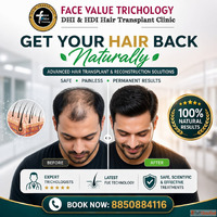 Get Your Hair Back Naturally Advanced Hair Transplant in Che...