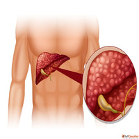Liver Endoscopy and Digestive Health Care by the Best Gastro...