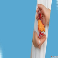 Pancreas Surgery for Complex Pancreatic Conditions and Diges...