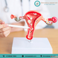 Advanced Gynecological Cancer Treatment in Ahmedabad