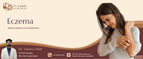 Eczema Care Treatment in Ahmedabad Trusted Dermatologists
