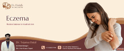 Eczema Care Treatment in Ahmedabad Trusted Dermatologists
