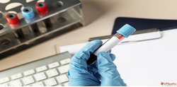 Choose Max Lab for Affordable Accurate Inflammation Testing