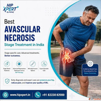 Best Avascular Necrosis Stage Treatment in India - HipXpert