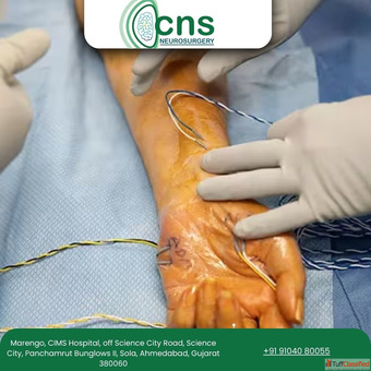 Safe Advanced Peripheral Nerve Repair in Ahmedabad - Dr Chirag Solanki