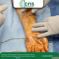 Safe Advanced Peripheral Nerve Repair in Ahmedabad - Dr Chir...