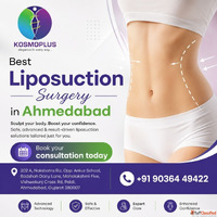 Best Cosmetic Fat Removal in Ahmedabad - Kosmo Plus Hospital