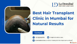 Best Hair Transplant Clinic in Mumbai for Natural Results