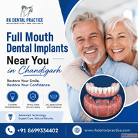 Full Mouth Dental Implants Near You in Chandigarh