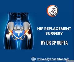 HIP REPLACEMENT SURGERY IN LUCKNOW - DR. CP GUPTA