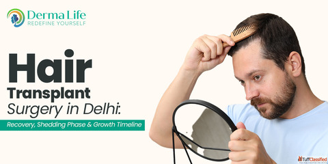 Hair Transplant Cost in Delhi Complete Graft-Wise Pricing Guide Boosted FUE Cost