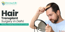 Hair Transplant Cost in Delhi Complete Graft-Wise Pricing Gu...
