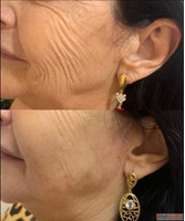 Lash Lift and Tint Sherwood Park