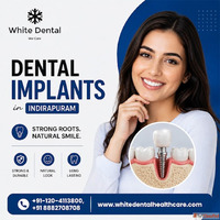 Dental Implants in Indirapuram for Permanent Tooth Replaceme...