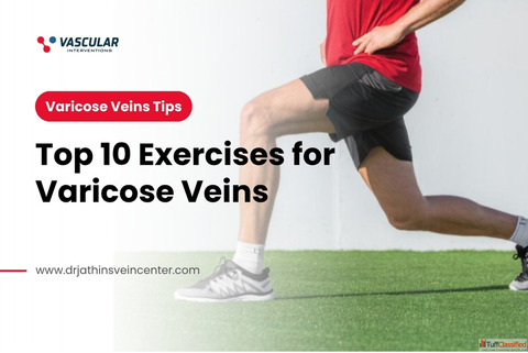 Improve Circulation and Leg Comfort with These 10 Easy Exercises