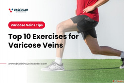 Improve Circulation and Leg Comfort with These 10 Easy Exerc...