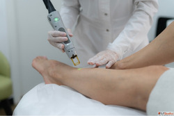 The Best Laser Hair Removal Solutions for Dark Skin in Dubai