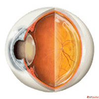 Cataract Surgery Bangalore - FLACS Bladeless MICS Phaco Surg...