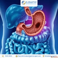 Personalized Gastrointestinal Cancer Care by Dr. Dhaval Pate...