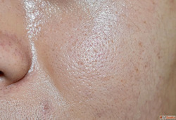 How to Control Oily Skin Simple Daily Skincare Tips for a Fr...