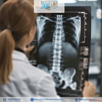 Trusted Spine Specialist Dr. Rohit Taker for Spinal Fracture