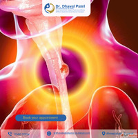 Expert Management of Esophageal Cancer and Tumors in Ahmedab...