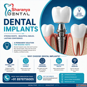 Dental Implants in Kondapur The Best Solution for Permanent Tooth Replacement