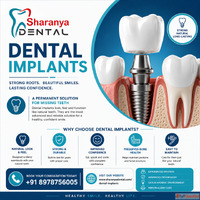 Dental Implants in Kondapur The Best Solution for Permanent ...