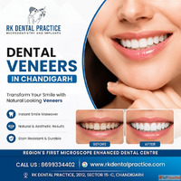 Dental Veneers Near You for a Perfect Smile Transformation