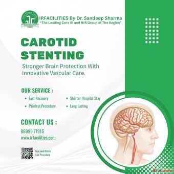 Most Effective Procedure for Carotid Artery Stenting in India