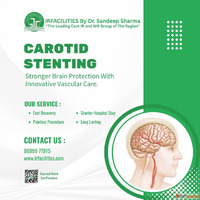 Most Effective Procedure for Carotid Artery Stenting in Indi...