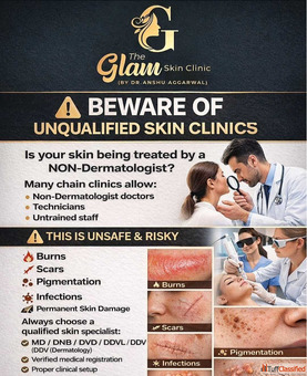 Pigmentation Treatment in Chandigarh