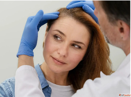 Exploring Regenerative Therapies for Hair Loss