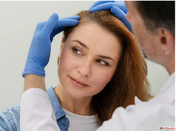 Exploring Regenerative Therapies for Hair Loss