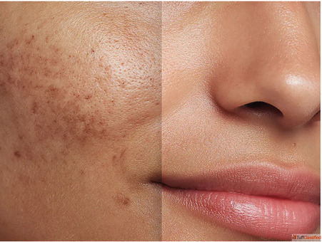 Expert Pigmentation Treatment Solutions