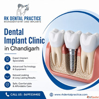 Dental Implant Clinic in Chandigarh for Advanced Tooth Repla...